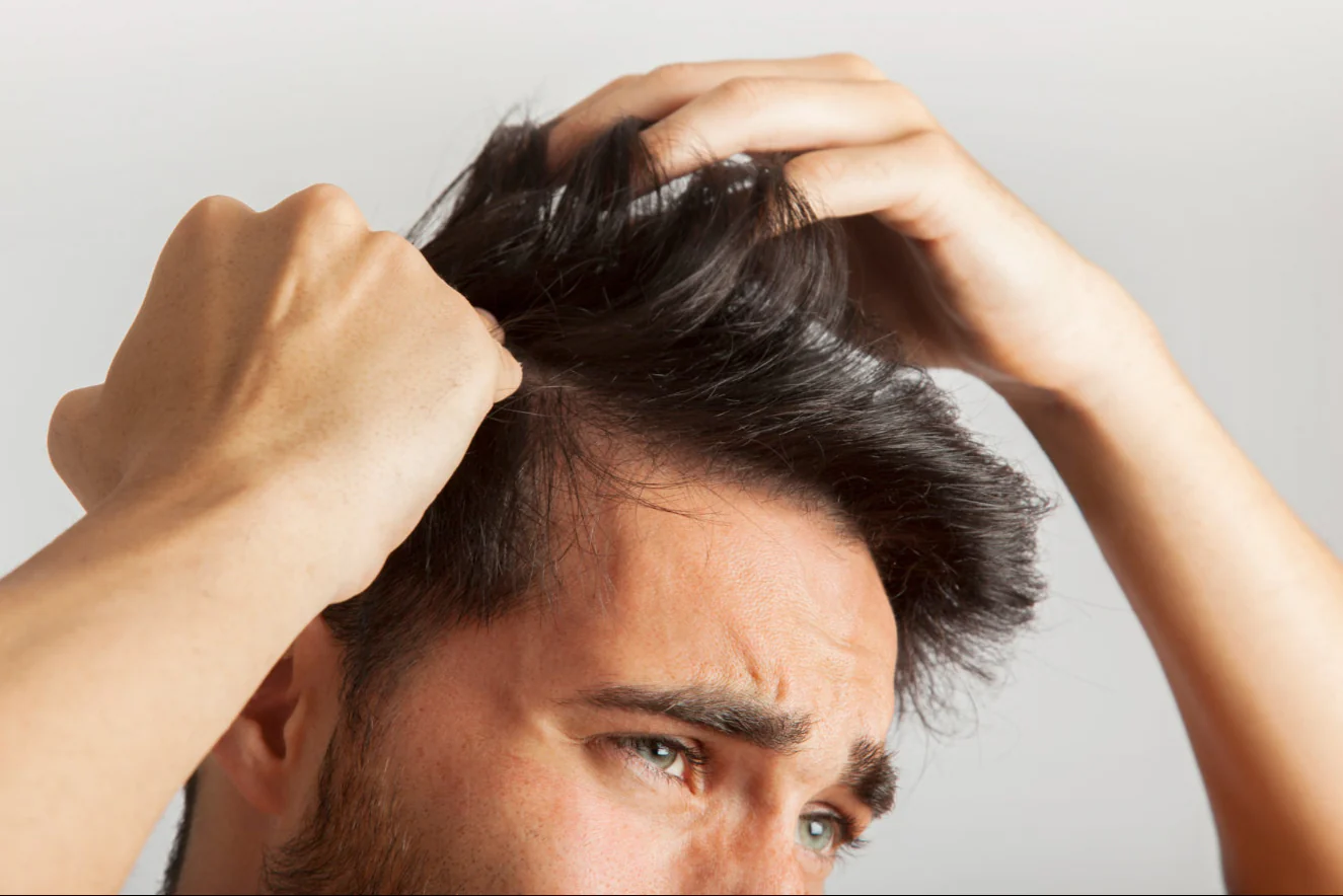 man loosing hair
